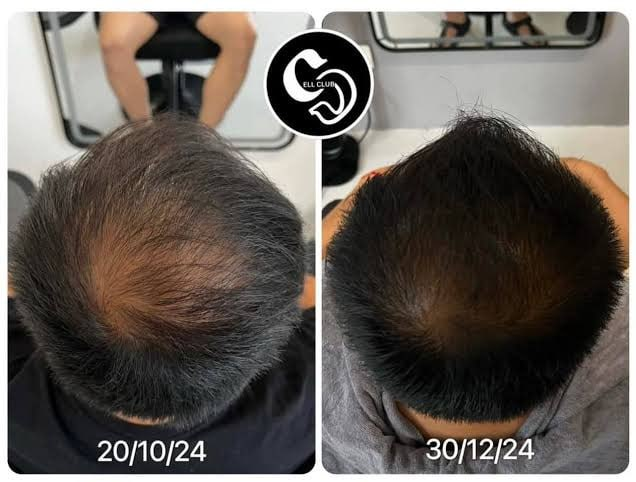 Comparativa capilar antes y después, imagen 7
